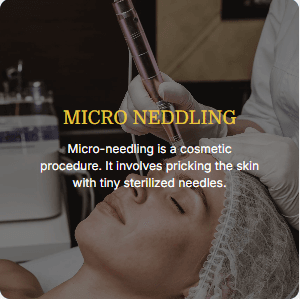 Micro Needling